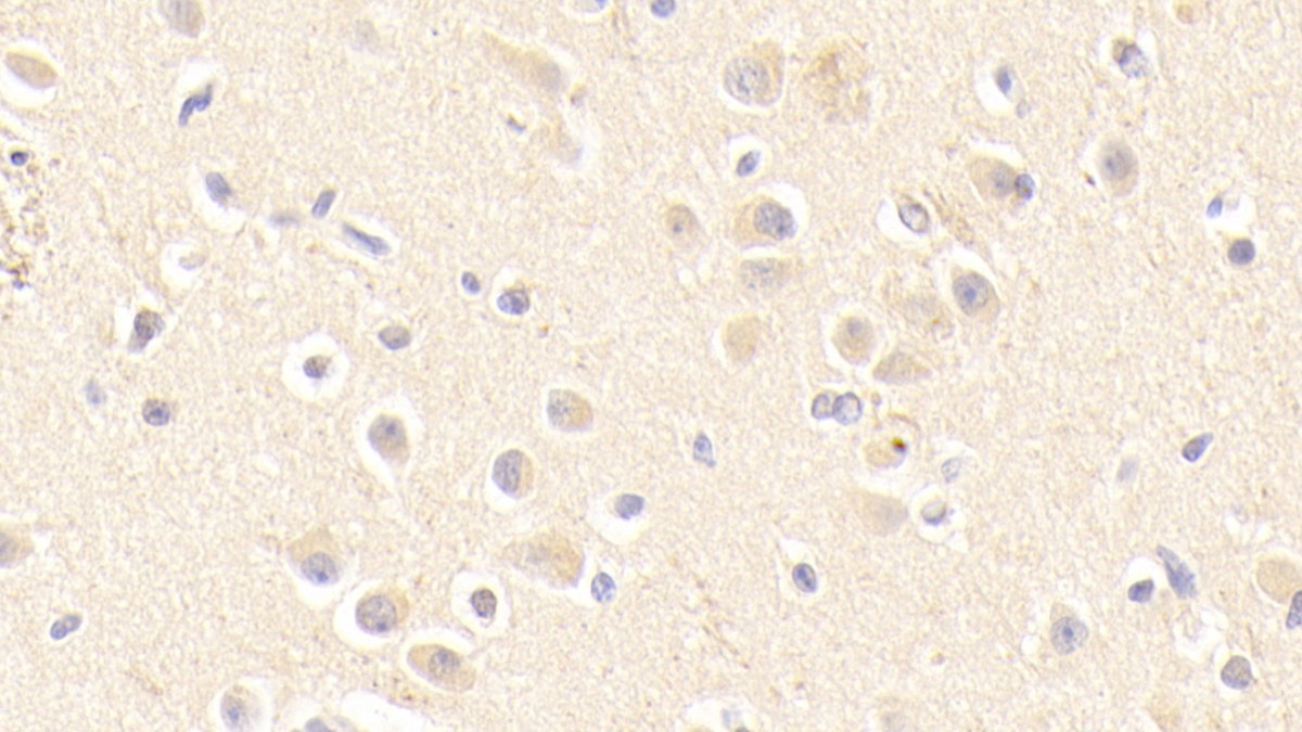 Polyclonal Antibody to Apolipoprotein E (APOE)