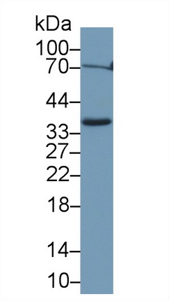 Polyclonal Antibody to Apolipoprotein E (APOE)