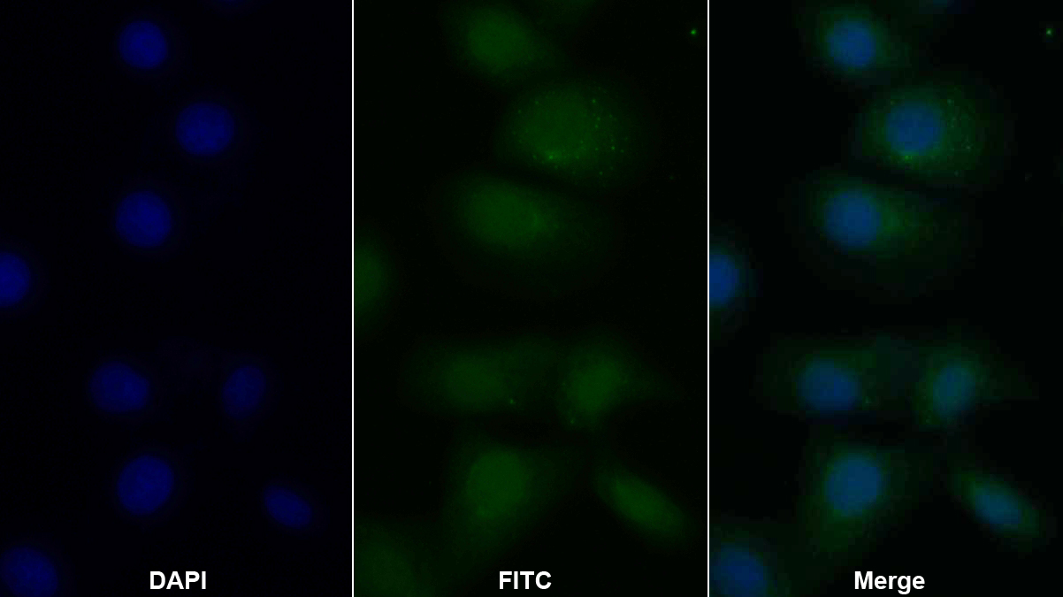 Polyclonal Antibody to Toll Like Receptor 9 (TLR9)