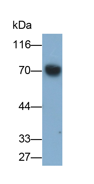 Polyclonal Antibody to Prothrombin Fragment 1+2 (F1+2)