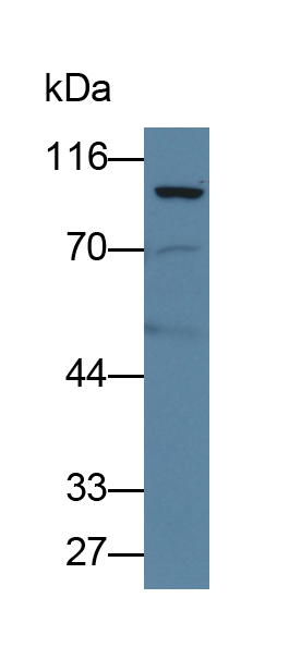 Polyclonal Antibody to Prothrombin Fragment 1+2 (F1+2)