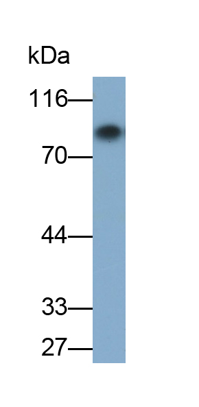 Polyclonal Antibody to Prothrombin Fragment 1+2 (F1+2)