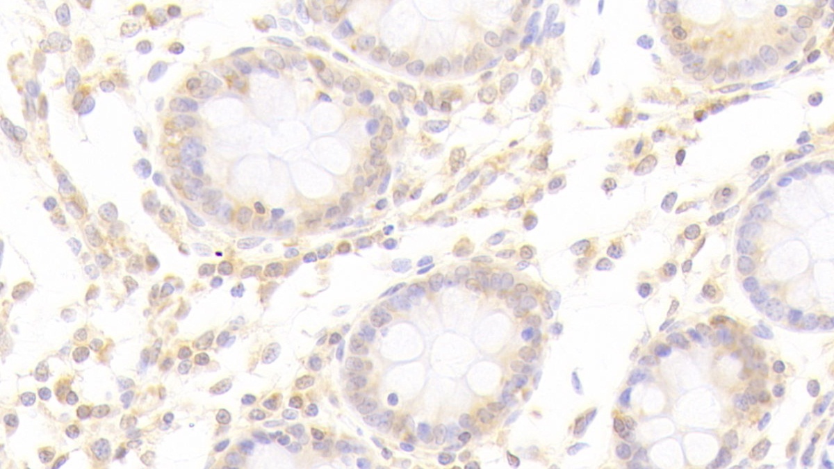 Polyclonal Antibody to Heparanase (HPSE)