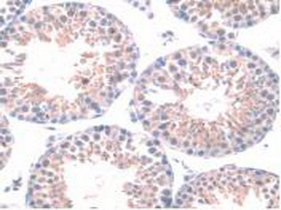 Polyclonal Antibody to Heparanase (HPSE)