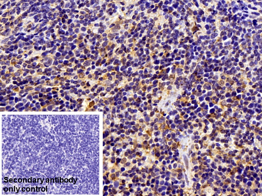 Polyclonal Antibody to Heparanase (HPSE)