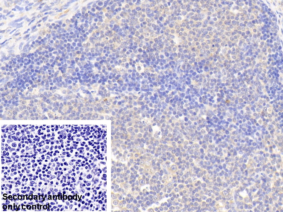 Polyclonal Antibody to Glucose-6-phosphate Dehydrogenase (G6PD)