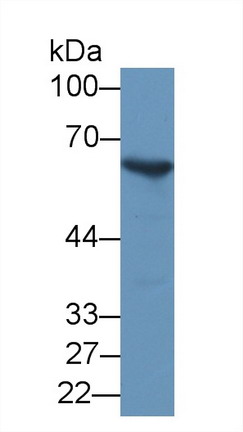 Polyclonal Antibody to Glucose-6-phosphate Dehydrogenase (G6PD)