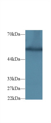 Polyclonal Antibody to Glucose-6-phosphate Dehydrogenase (G6PD)