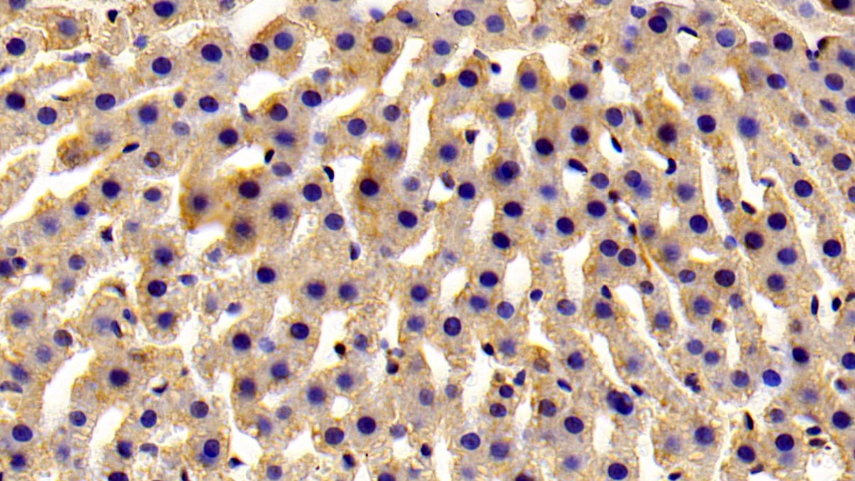 Polyclonal Antibody to ADP Ribosyltransferase 4 (ART4)
