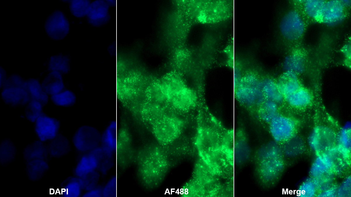 Polyclonal Antibody to Prostaglandin-H2 D-isomerase (PTGDS)