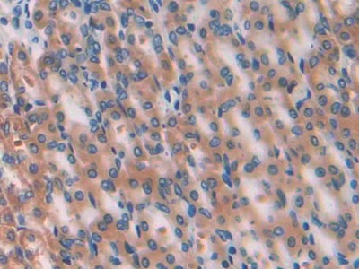 Polyclonal Antibody to Glucose 6 Phosphate Isomerase (GPI)