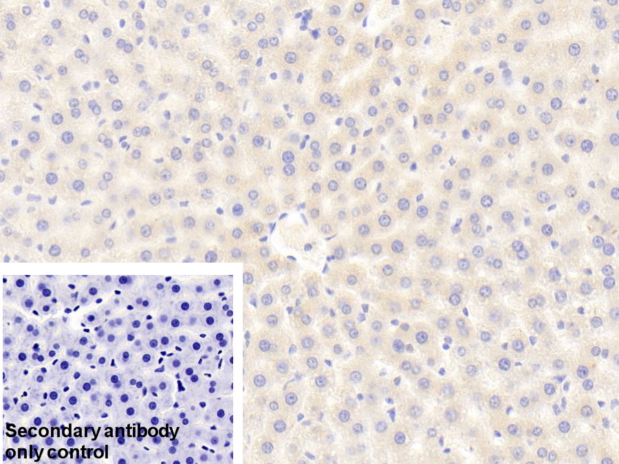 Polyclonal Antibody to Prealbumin (PALB)