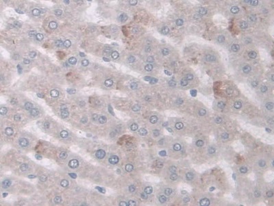 Polyclonal Antibody to Cyclooxygenase 1 (COX-1)