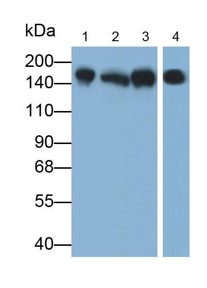 Polyclonal Antibody to Desmoglein 1 (DSG1)