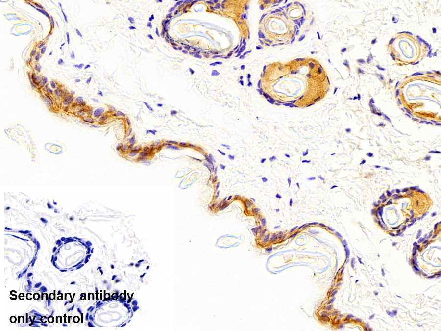 Polyclonal Antibody to Desmoglein 1 (DSG1)
