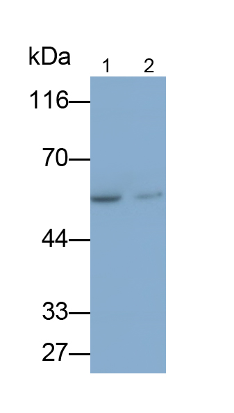 Polyclonal Antibody to Bone Morphogenetic Protein Receptor 1B (BMPR1B)