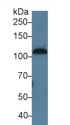 Polyclonal Antibody to Complement Component 7 (C7)