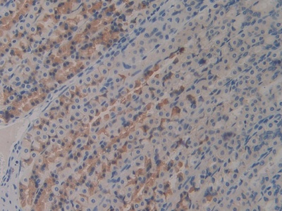 Polyclonal Antibody to Complement Component 7 (C7)