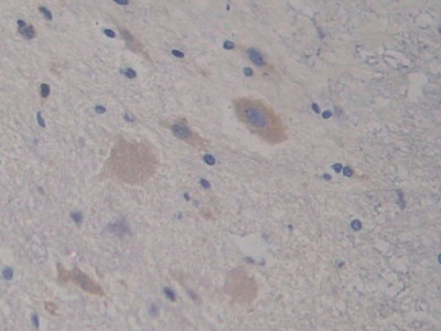 Polyclonal Antibody to Complement Component 7 (C7)