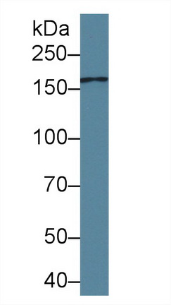 Polyclonal Antibody to Mannose Receptor C Type 2 (MRC2)