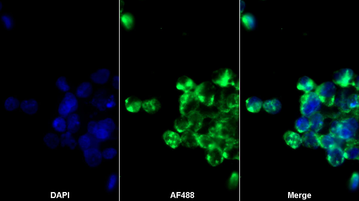 Polyclonal Antibody to Activated Protein C (APC)