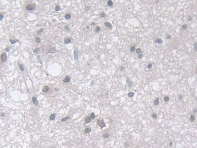 Polyclonal Antibody to Membrane Protein, Palmitoylated 5 (MPP5)