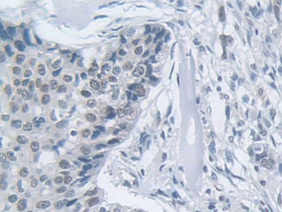 Polyclonal Antibody to Membrane Protein, Palmitoylated 5 (MPP5)
