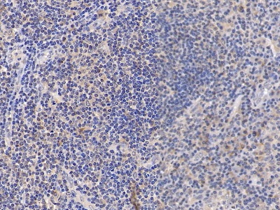 Polyclonal Antibody to Cluster Of Differentiation 38 (CD38)