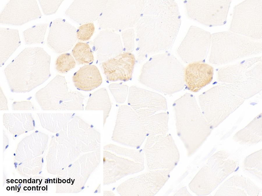 Polyclonal Antibody to Myosin Heavy Chain 1 (MYH1)