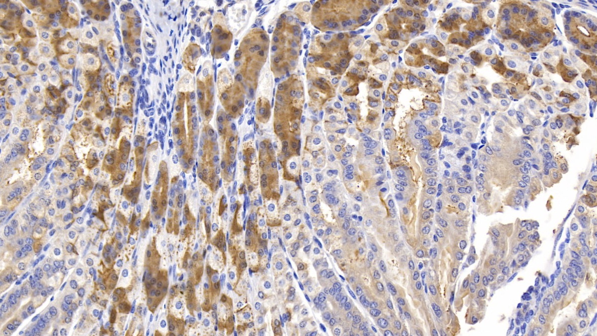 Polyclonal Antibody to Mucin 5 Subtype AC (MUC5AC)