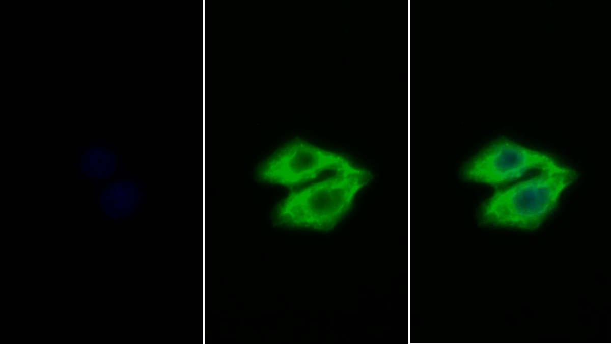 Polyclonal Antibody to Epidermal Growth Factor Receptor (EGFR)