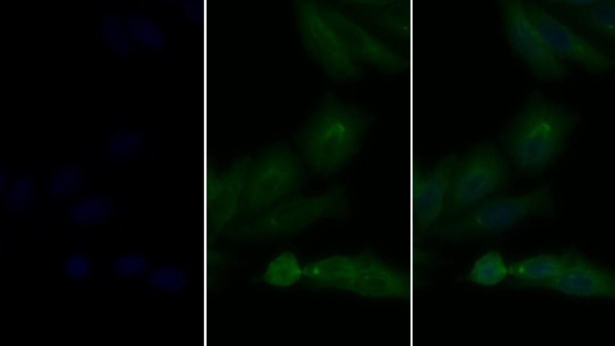 Polyclonal Antibody to Epidermal Growth Factor Receptor (EGFR)