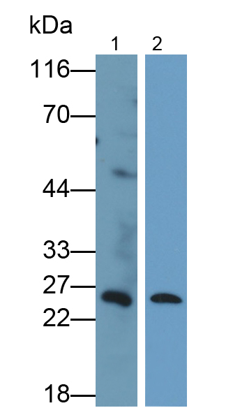 Polyclonal Antibody to B-Cell Leukemia/Lymphoma 2 (Bcl2)