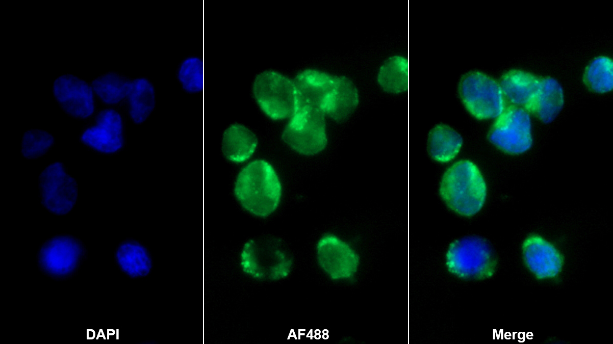 Polyclonal Antibody to Lactoferrin (LTF)