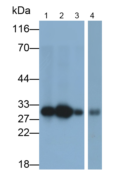 Polyclonal Antibody to Carbonic Anhydrase II (CA2)