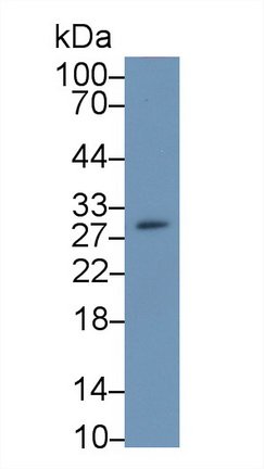 Polyclonal Antibody to Carbonic Anhydrase II (CA2)