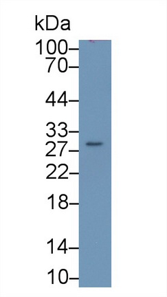 Polyclonal Antibody to Carbonic Anhydrase II (CA2)