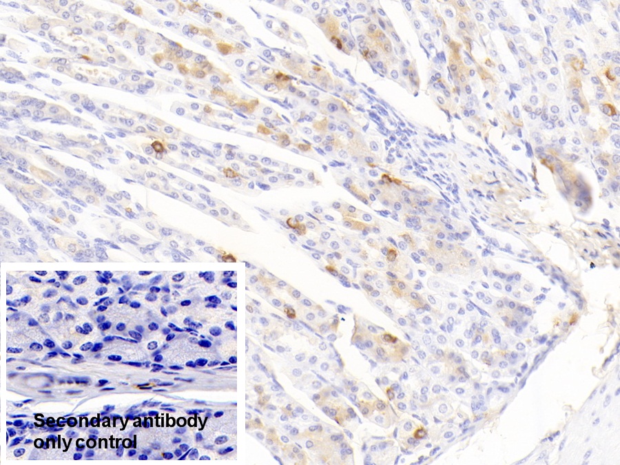 Polyclonal Antibody to Ficolin 1 (FCN1)