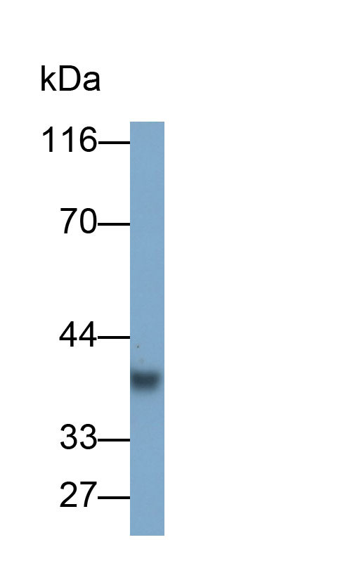 Polyclonal Antibody to Ficolin 1 (FCN1)