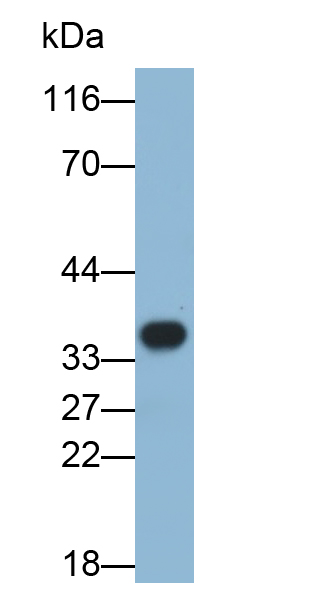 Polyclonal Antibody to Ficolin 1 (FCN1)