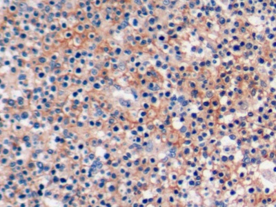 Polyclonal Antibody to Programmed Cell Death Protein 1 Ligand 2 (PDL2)