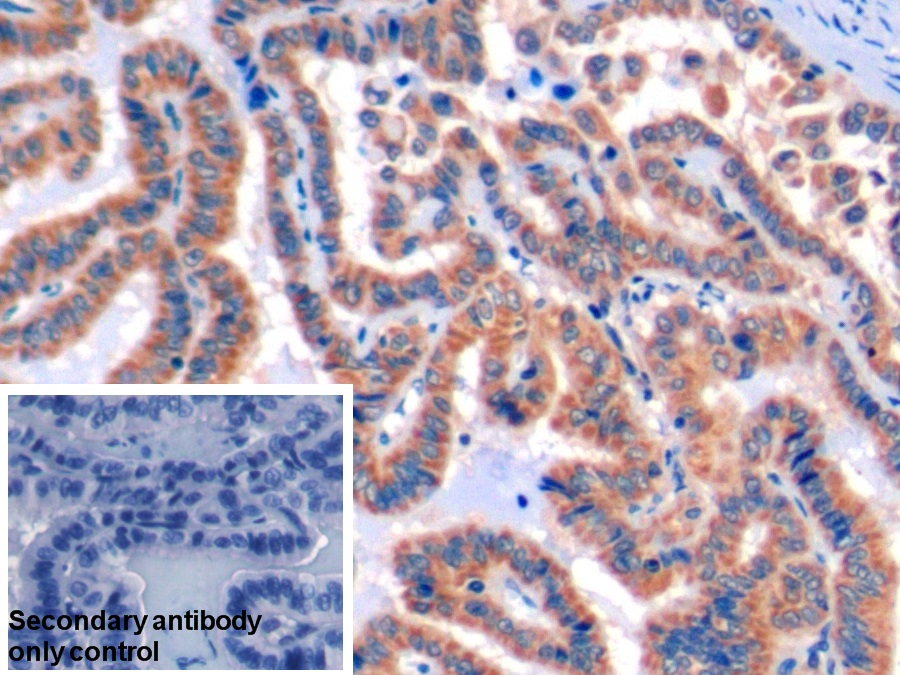 Polyclonal Antibody to Programmed Cell Death Protein 1 Ligand 2 (PDL2)