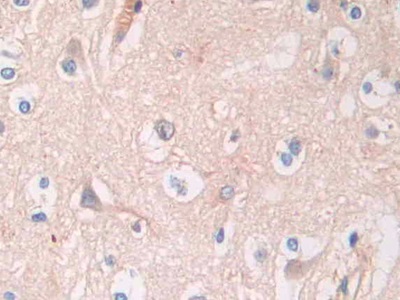 Polyclonal Antibody to Angiotensinogen (AGT)