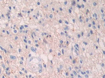 Polyclonal Antibody to Hypoxia Inducible Factor 1 Alpha (HIF1a)