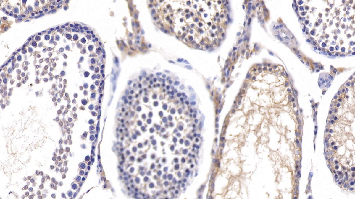 Polyclonal Antibody to Fucosidase Alpha L1, Tissue (FUCa1)