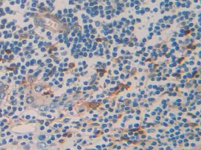 Polyclonal Antibody to Tumor Necrosis Factor Receptor Superfamily, Member 12A (TNFRSF12A)