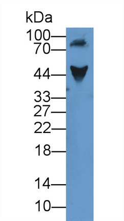 Polyclonal Antibody to Alpha-1-Acid Glycoprotein (a1AGP)