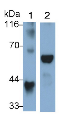 Polyclonal Antibody to Alpha-1-Acid Glycoprotein (a1AGP)