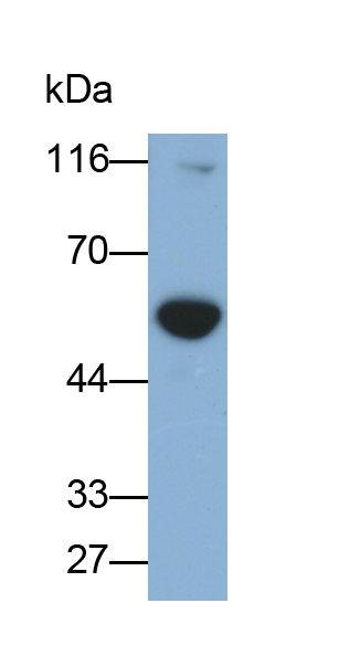 Polyclonal Antibody to Alpha-1-Acid Glycoprotein (a1AGP)