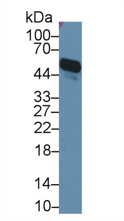 Polyclonal Antibody to Alpha-1-Acid Glycoprotein (a1AGP)